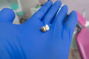 Treatments for Genital Warts